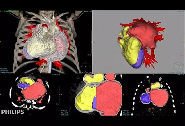 Highlights l 盤點FDA 批準的醫療模型3D打印軟件及醫學影像巨頭對該市場的滲透