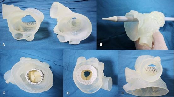 逐漸納入醫(yī)保范圍的3D打印模型，將會(huì)對(duì)醫(yī)工結(jié)合帶來哪些不同？